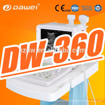 Appareil diagnostique médical portatif de l&#39;écran 12&#39;&#39;LED de DW360 et scanner portatif de sonoline à vendre